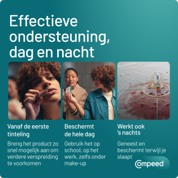 Compeed Koortslippleisters 30 stuks