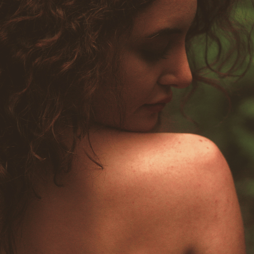 Vitamine C en je huid: antioxidanten, glow en ondersteuning bij pigmentatie