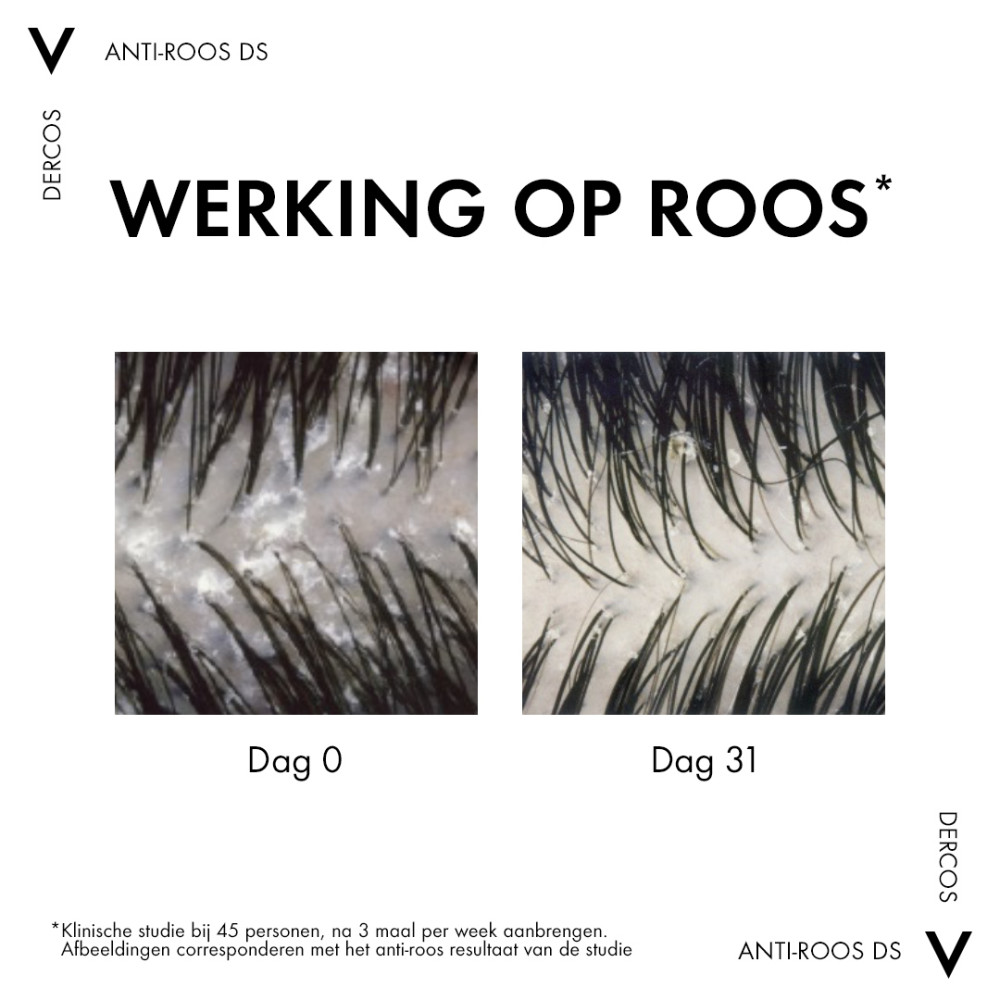 Vichy Dercos Anti-Roos Shampoo Droog Haar 200ml