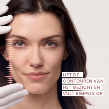 Avène Hyaluron Activ Prodcedure Oog Lipcontour Crème 15ml