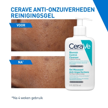 CeraVe Anti-Onzuiverheden Reinigingsgel 473ml