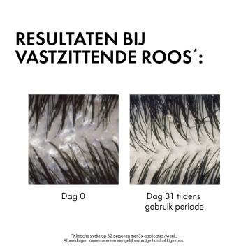 Vichy Dercos Anti-Roos DS Shampoo Droog Haar Navulling 390ml