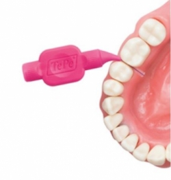 TePe Interdentalbürsten Klinikpackung 1,50 mm (schwarz) – 25 Stk.
