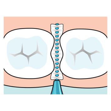 TePe Original Interdentalbürsten 0,60 mm blau – 1x6 Stk.
