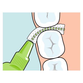 TePe Original Interdentalbürsten 0,80 mm grün – 1x6 Stk.