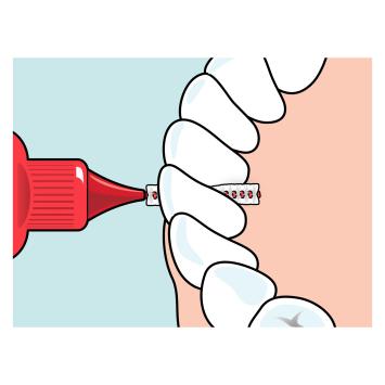 TePe Original Interdentalbürsten 0,50 mm rot – 1x6 Stk.