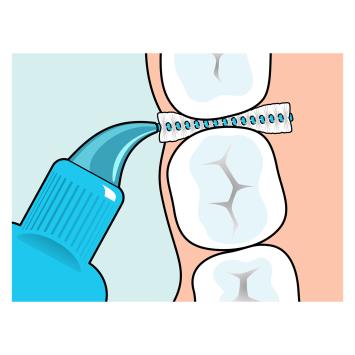 TePe Original Interdentalbürsten 0,60 mm blau – 1x6 Stk.