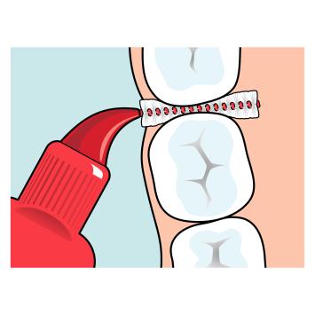 TePe Original Interdentalbürsten 0,50 mm rot – 1x6 Stk.