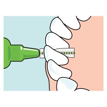 TePe Original Interdentalbürsten 0,80 mm grün – 1x6 Stk.