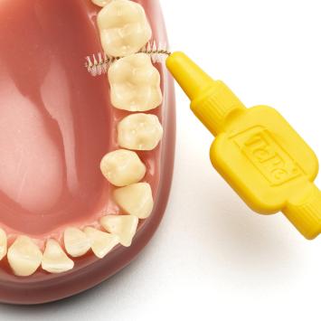 TePe Original Interdentalbürsten 0,70 mm gelb – 1x6 Stk.