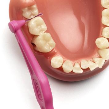 TePe Angle 0,4 mm rosa – 1x6 Stk.