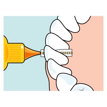 TePe Original Interdentalbürsten 0,45 mm orange – 1x6 Stk.