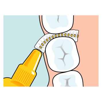 TePe Original Interdentalbürsten 0,45 mm orange – 1x6 Stk.