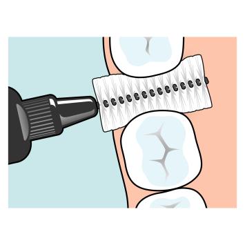 TePe Original Interdentalbürsten 1,50 mm schwarz – 10x6 Stk.
